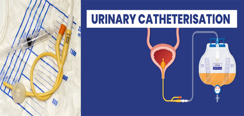 livin-with-urinary-catheter-medekom